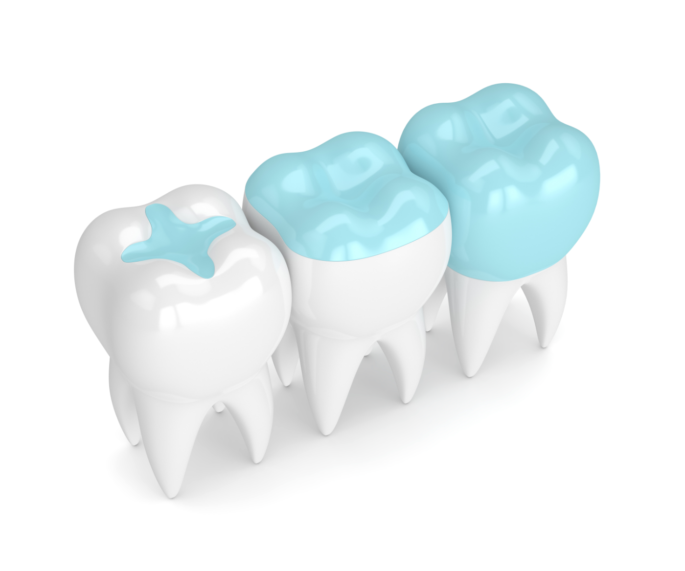 むし歯治療で欠かせない詰め物・被せ物の重要性
